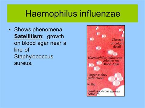 beta lactamase positive h flu|Antimicrobial Resistance in Haemophilus influenzae .